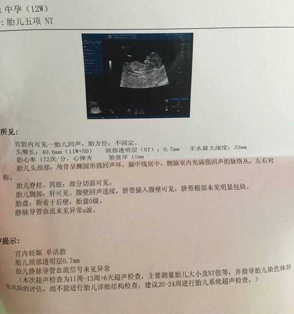 杭州代孕第三代，2022年杭州第三代试管婴儿医院排名